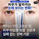 락티스크림 고르는 법, 피부 타입별 맞춤 성분과 실패 없는 선택 기준